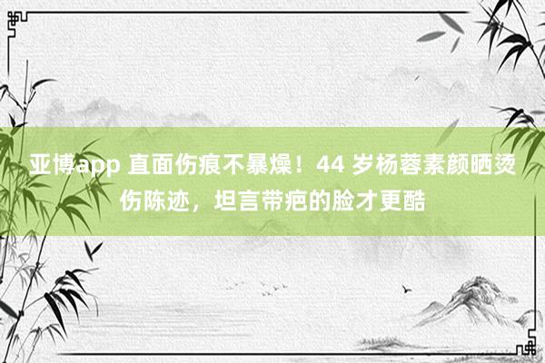亚博app 直面伤痕不暴燥！44 岁杨蓉素颜晒烫伤陈迹，坦言带疤的脸才更酷